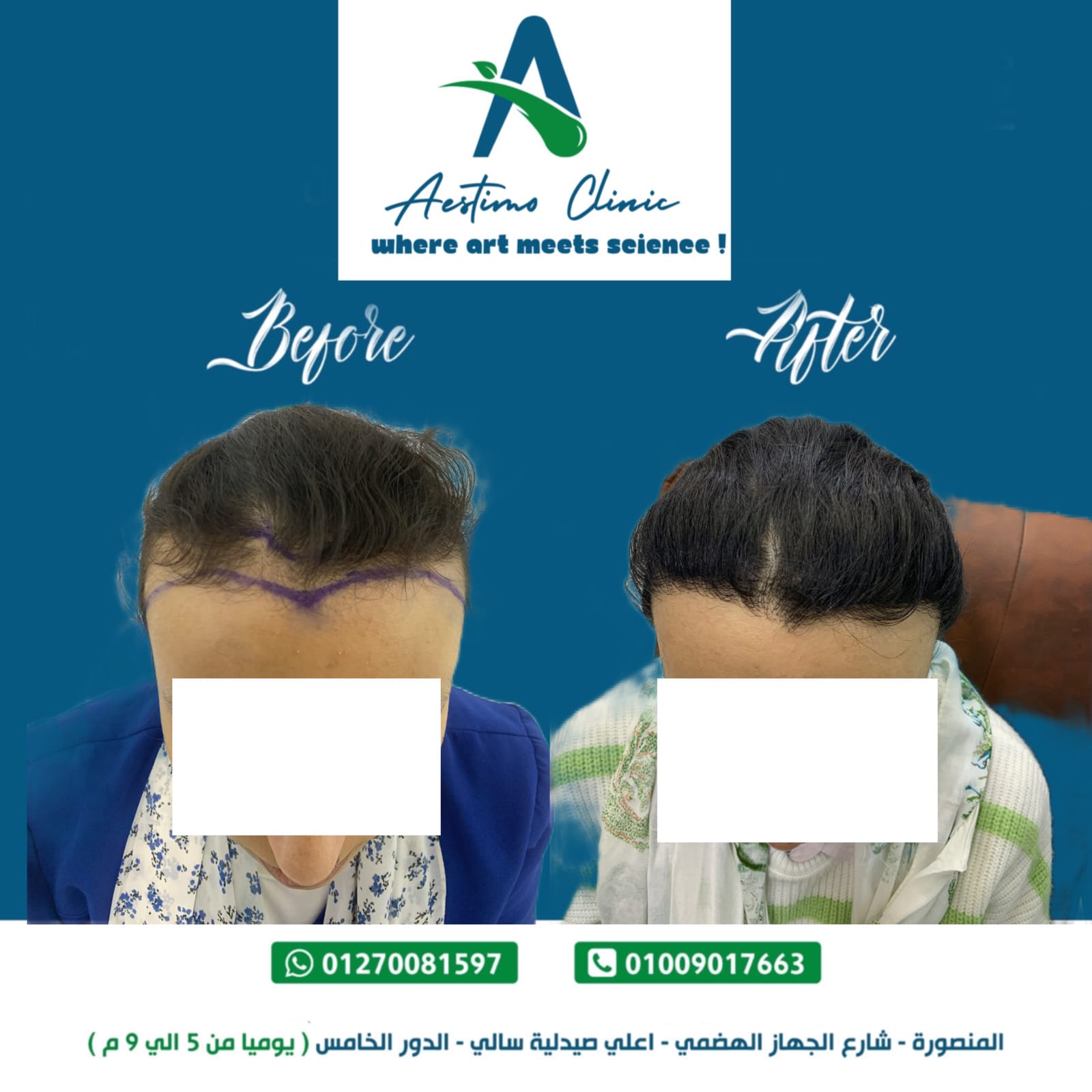 393e7c5b f893 4336 bd7f 9d0f27e2d45b