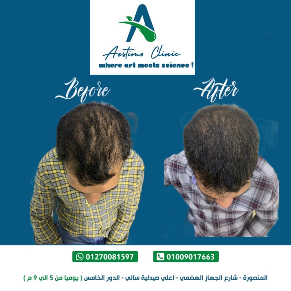 5dedb0ed 22e3 4b7f 8457 1cc8eb4cb1b8