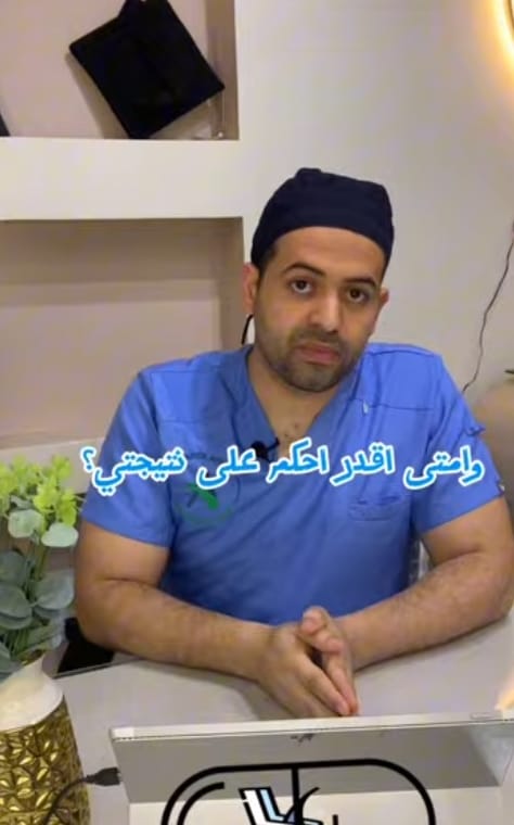 نتيجة زراعة شعر المنصورة