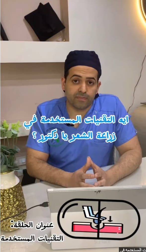 التقنيات المستخدمة لزراعة الشعر